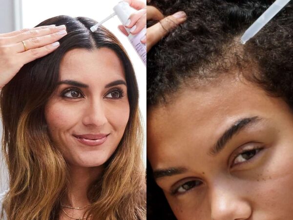 The Benefits of Hair Loss Treatments Like Minoxidil and Finasteride