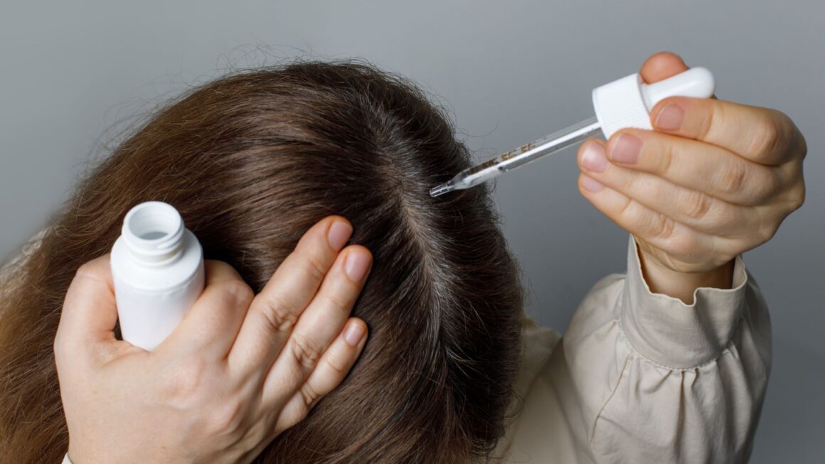 Hair Loss