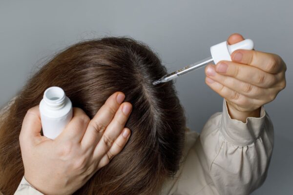 The Benefits of Hair Loss Treatments Like Minoxidil and Finasteride